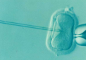 三分之一的生育专家仍然推荐一种没有明确证据表明有益的 IVF 治疗