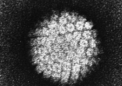 在可持续数年的干预措施后 HPV 疫苗接种覆盖率有所提高