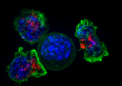 研究发现干细胞在致命胃癌中的详细作用