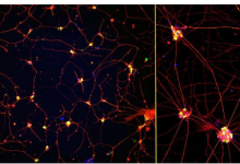 成熟的实验室培养神经元有望治疗神经退行性疾病