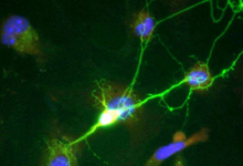 了解 tau 蛋白如何在神经元之间移动可以深入了解神经退行性疾病的治疗方法