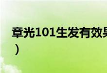 章光101生发有效果吗（章光101生发有用吗）