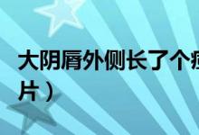 大阴脣外侧长了个痘痘（大阴纯外侧长痘痘图片）