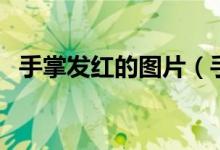 手掌发红的图片（手掌发红的图片及原因）