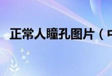 正常人瞳孔图片（中国人瞳孔有几种颜色）