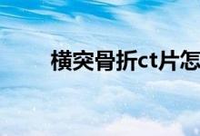 横突骨折ct片怎么看（ct片怎么看）