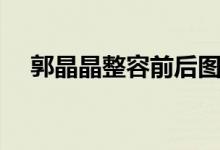 郭晶晶整容前后图片（郭晶晶整容前后）