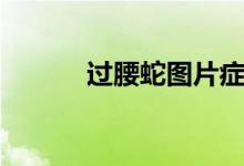 过腰蛇图片症状（过腰蛇图片）