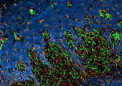 蛋白质-蛋白质相互作用的发现为未来胶质母细胞瘤治疗奠定基础