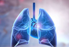 肺活量测定正常时疑似支气管扩张与死亡率相关