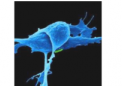 抗体可减缓小鼠肿瘤的生长和转移