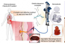 创新凝胶为治疗胃肠道渗漏带来新希望