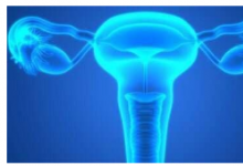 高级别浆液性卵巢癌的早期诊断可行