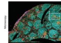 通过 PD-1 实现 T 细胞复兴：癌症免疫治疗的线索