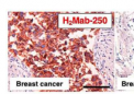 科学家开发出新的单克隆抗体来治疗 HER2 阳性乳腺癌