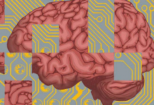 研究人员利用人工智能来预测 检测阿尔茨海默病