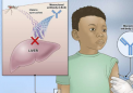 实验性疟疾单克隆抗体对马里儿童具有保护作用