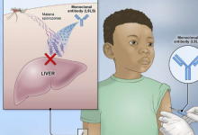实验性疟疾单克隆抗体对马里儿童具有保护作用