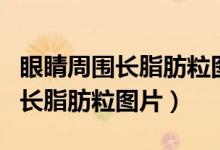 眼睛周围长脂肪粒图片是什么原因（眼睛周围长脂肪粒图片）