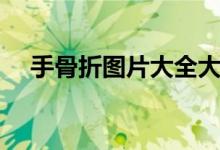 手骨折图片大全大图（手骨折图片大全）