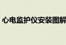 心电监护仪安装图解（心电监护仪连接图片）